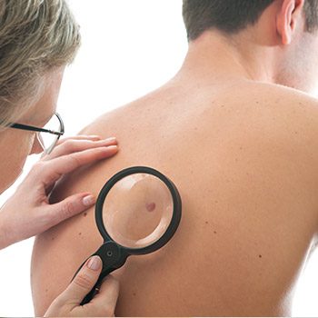 Can a doctor cure skin cancer with surgery