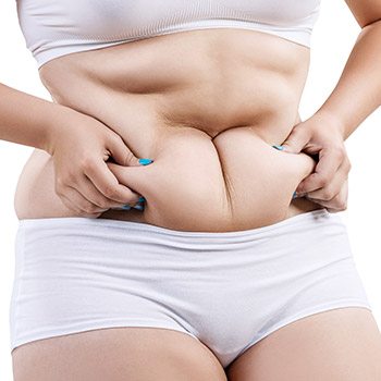 Who can benefit from SmartLipo