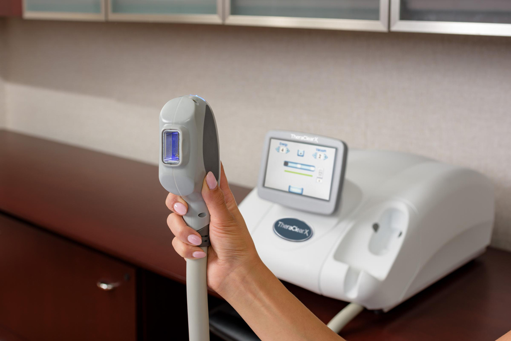 TheraClear Device - TheraClear Acne Treatment Walnut Creek CA